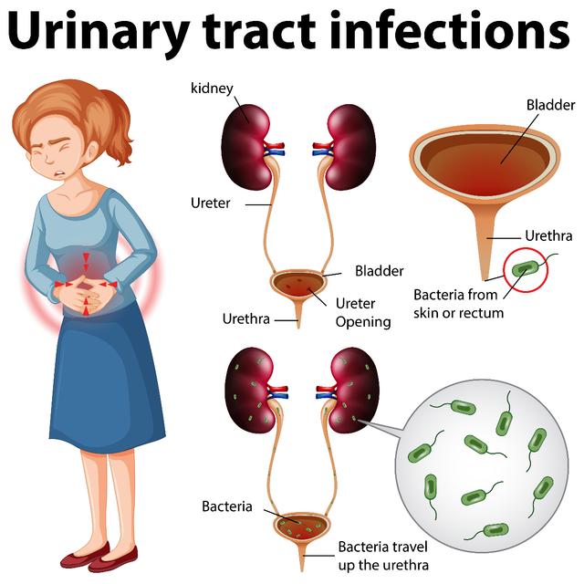 Urinary Tract and Genital infections