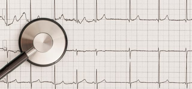 Rhythm of the Heart Navigating Life with Arrhythmia