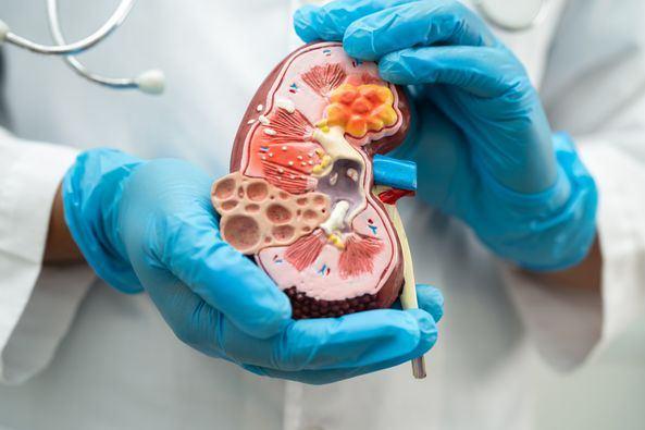 Kidney Disease Understanding Types Prevention Risk Cause and Treatment